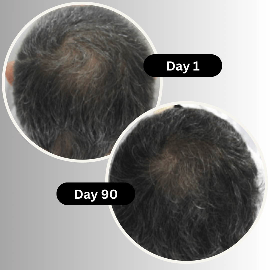 Multi Peptide Anti Grey Serum And Hair Loss Treatment, Clinical Testing Result