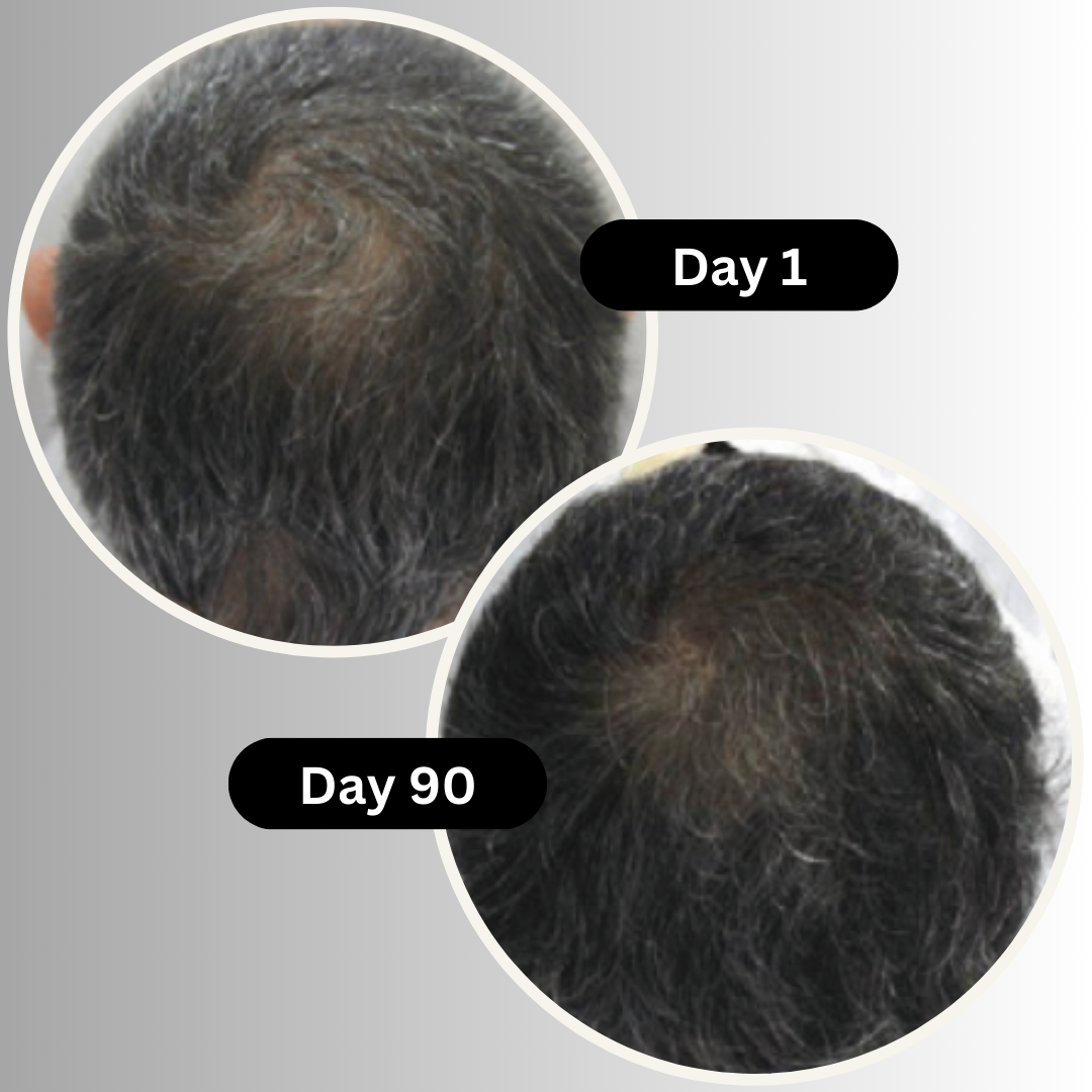 HALFTONE Multi-Peptide Grey Hair Treatment Serum - Advance Anti-Grey Formula Before and After Effective Solution